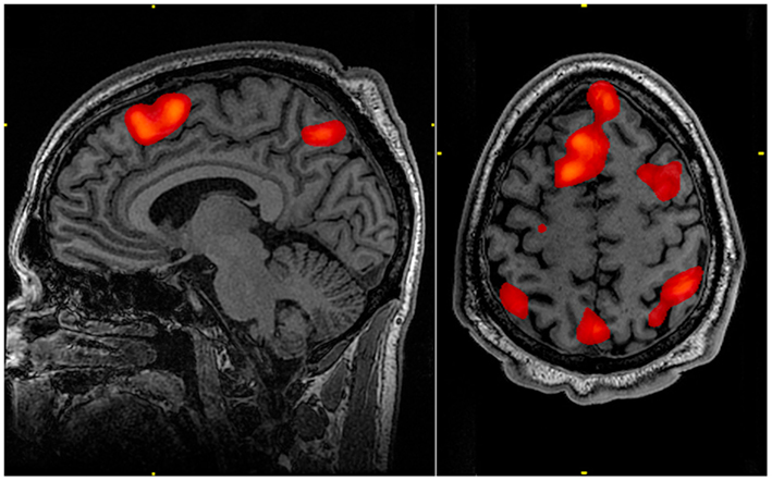 Saúde - geral - neurologia psicologia cérebro cabeça pensamentos exames médicos